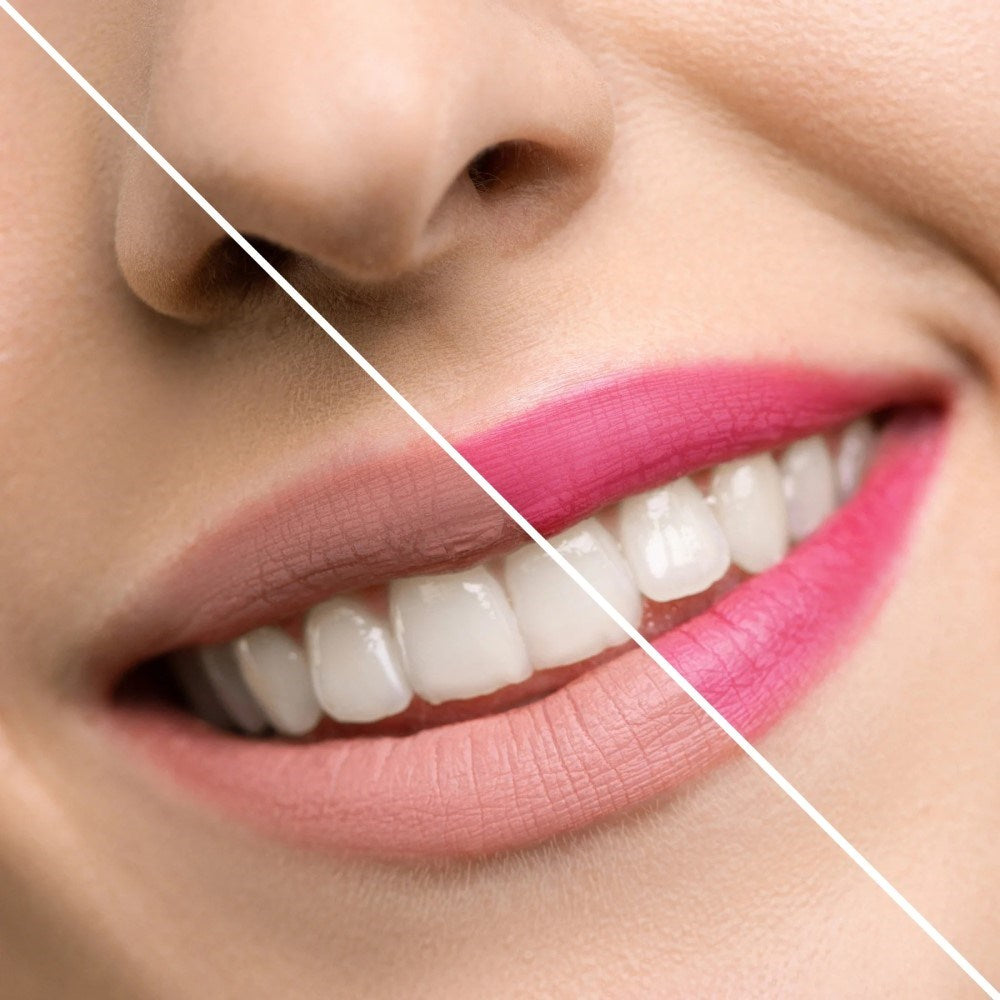 Inuwet Limon Kokulu Dudak Koruyucu Lip Stick